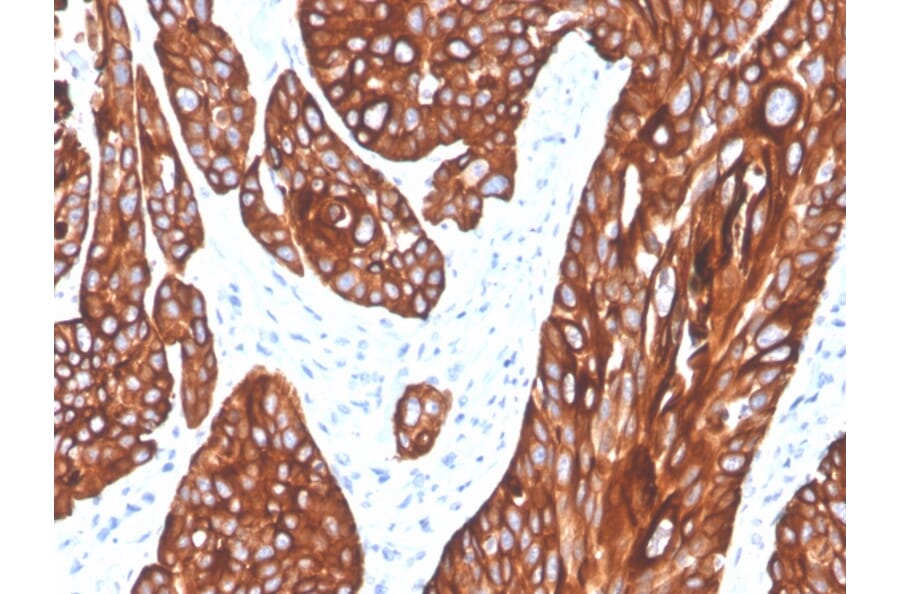 Immunohistochemistry - Anti-Cytokeratin 5 Antibody [rKRT5/6398] (A249125) - Antibodies.com