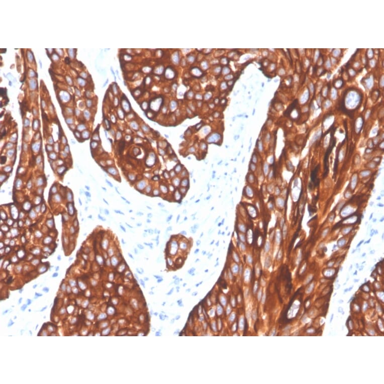 Immunohistochemistry - Anti-Cytokeratin 5 Antibody [rKRT5/6398] (A249125) - Antibodies.com