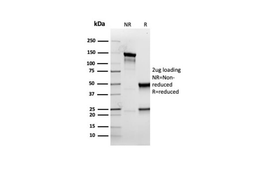 SDS-PAGE - Anti-Cytokeratin 5 Antibody [rKRT5/6398] (A249125) - Antibodies.com