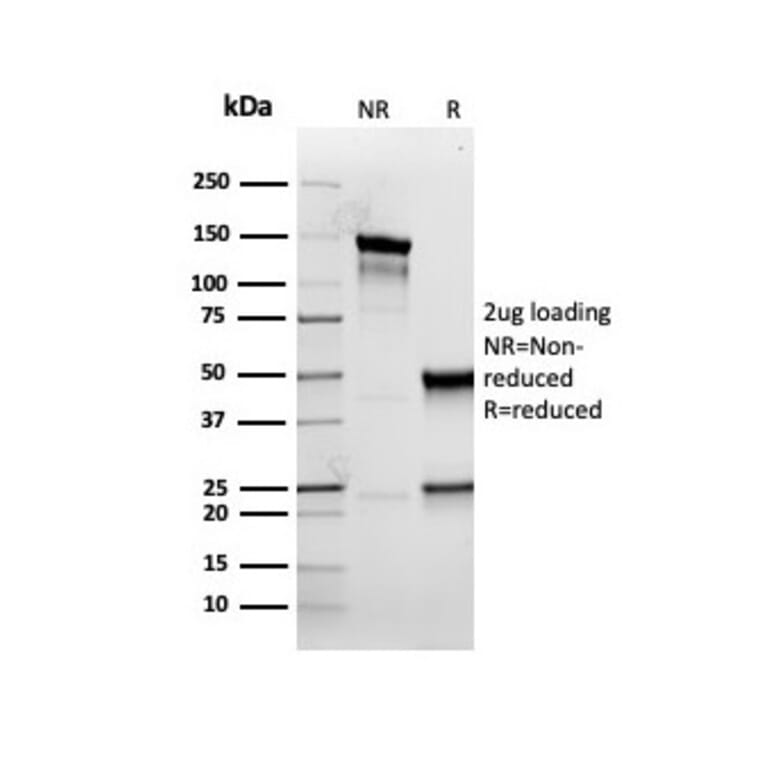 SDS-PAGE - Anti-Cytokeratin 5 Antibody [rKRT5/6398] (A249125) - Antibodies.com