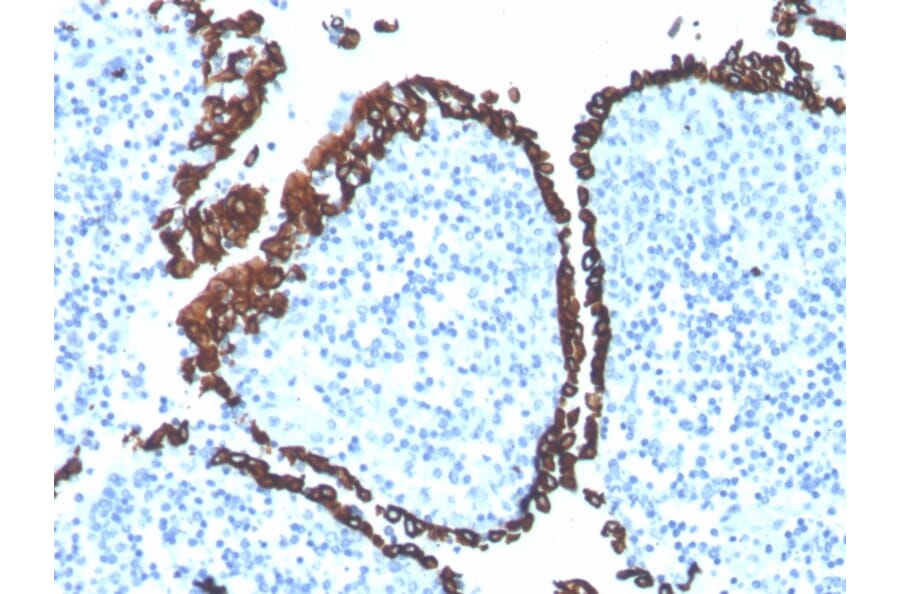 Immunohistochemistry - Anti-Cytokeratin 5 Antibody [KRT5/4245R] (A249126) - Antibodies.com