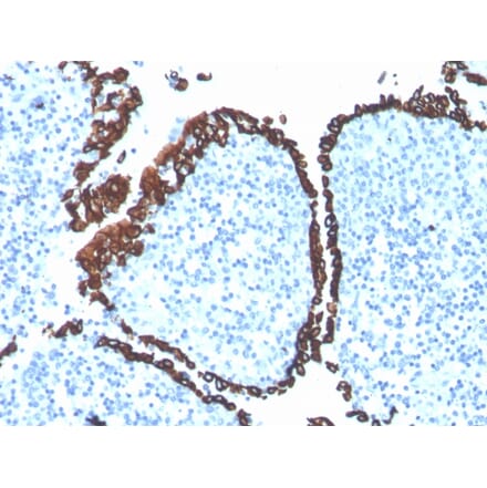 Immunohistochemistry - Anti-Cytokeratin 5 Antibody [KRT5/4245R] (A249126) - Antibodies.com