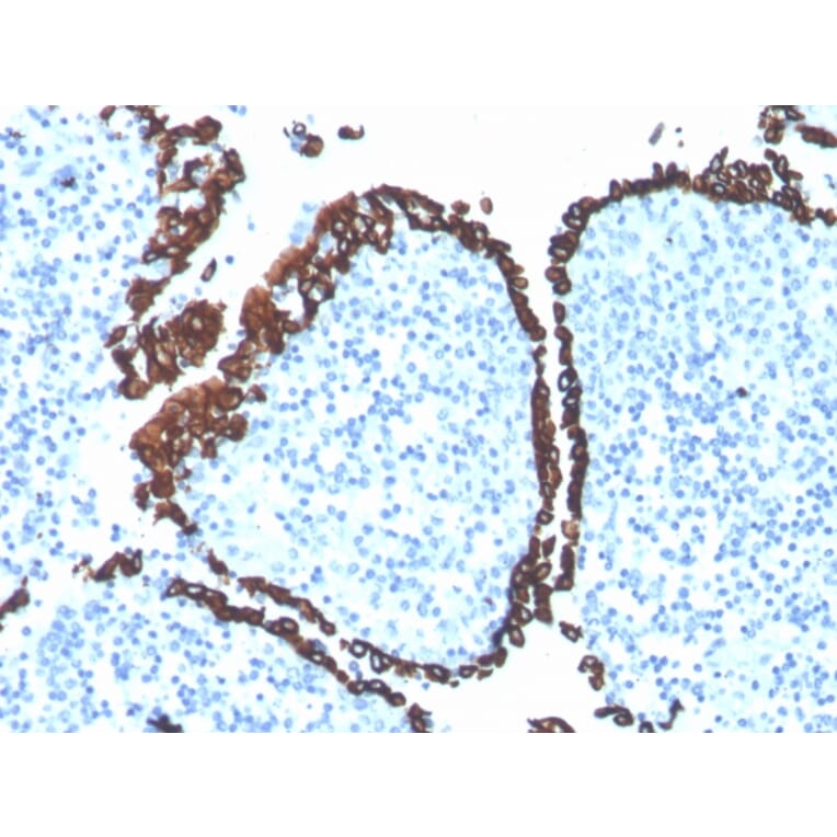 Immunohistochemistry - Anti-Cytokeratin 5 Antibody [KRT5/4245R] (A249126) - Antibodies.com