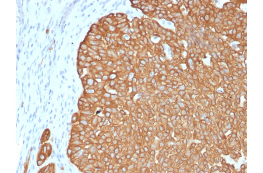 Immunohistochemistry - Anti-Cytokeratin 5 Antibody [KRT5/4245R] (A249125) - Antibodies.com