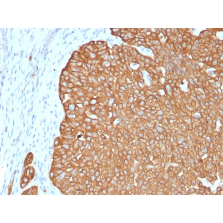Immunohistochemistry - Anti-Cytokeratin 5 Antibody [KRT5/4245R] (A249125) - Antibodies.com