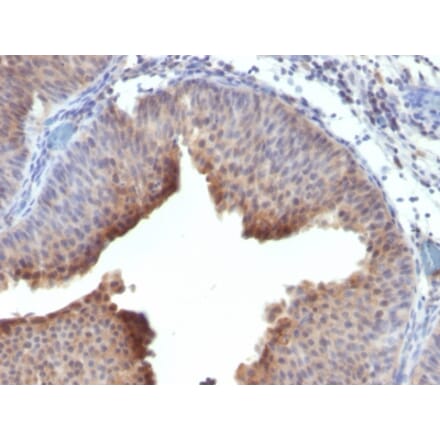 Immunohistochemistry - Anti-Cytokeratin 6 Antibody [LHK6] (A249126) - Antibodies.com