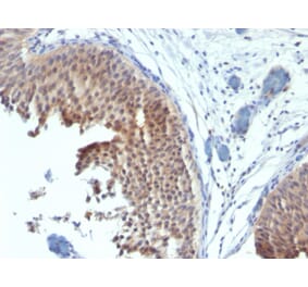 Immunohistochemistry - Anti-Cytokeratin 6 Antibody [SPM269] (A249128) - Antibodies.com