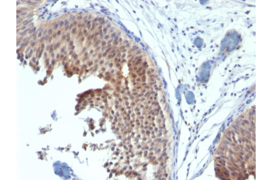 Immunohistochemistry - Anti-Cytokeratin 6 Antibody [SPM269] (A249128) - Antibodies.com