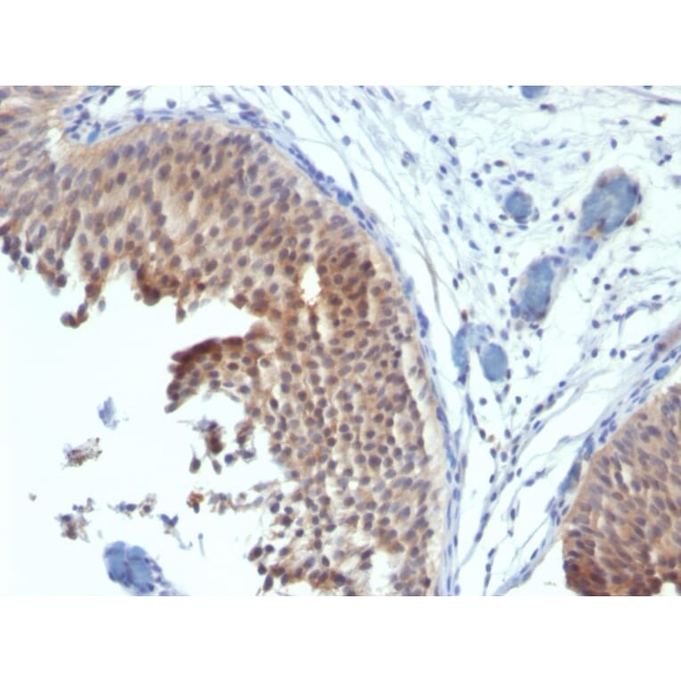 Immunohistochemistry - Anti-Cytokeratin 6 Antibody [SPM269] (A249128) - Antibodies.com