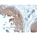 Immunohistochemistry - Anti-Cytokeratin 6 Antibody [SPM269] (A249128) - Antibodies.com