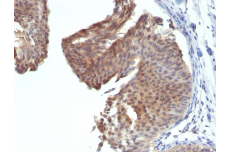 Immunohistochemistry - Anti-Cytokeratin 6 Antibody [KRT6/1702] (A249128) - Antibodies.com