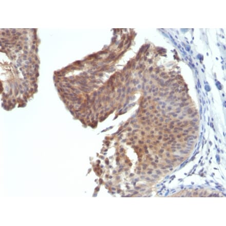 Immunohistochemistry - Anti-Cytokeratin 6 Antibody [KRT6/1702] (A249128) - Antibodies.com