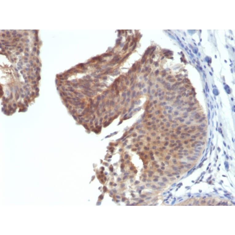 Immunohistochemistry - Anti-Cytokeratin 6 Antibody [KRT6/1702] (A249128) - Antibodies.com