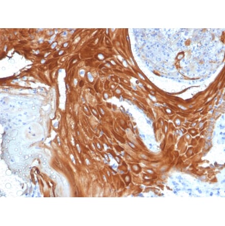 Immunohistochemistry - Anti-Cytokeratin 6A Antibody [KRT6A/2368] (A249130) - Antibodies.com