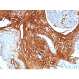 Immunohistochemistry - Anti-Cytokeratin 6A Antibody [KRT6A/2368] (A249130) - Antibodies.com