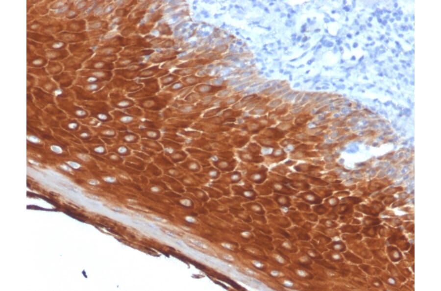 Immunohistochemistry - Anti-Cytokeratin 6A Antibody [KRT6A/2368] (A249130) - Antibodies.com