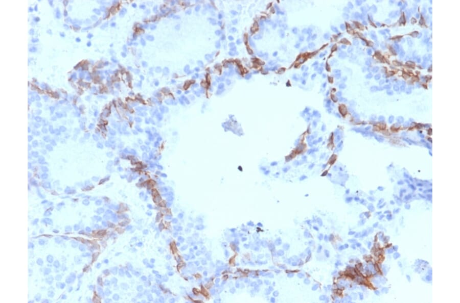 Immunohistochemistry - Anti-Cytokeratin 6A Antibody [KRT6A/2368] (A249130) - Antibodies.com