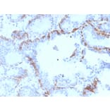Immunohistochemistry - Anti-Cytokeratin 6A Antibody [KRT6A/2368] (A249130) - Antibodies.com