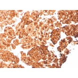 Immunohistochemistry - Anti-Cytokeratin 6A Antibody [rKRT6A/2100] (A249130) - Antibodies.com
