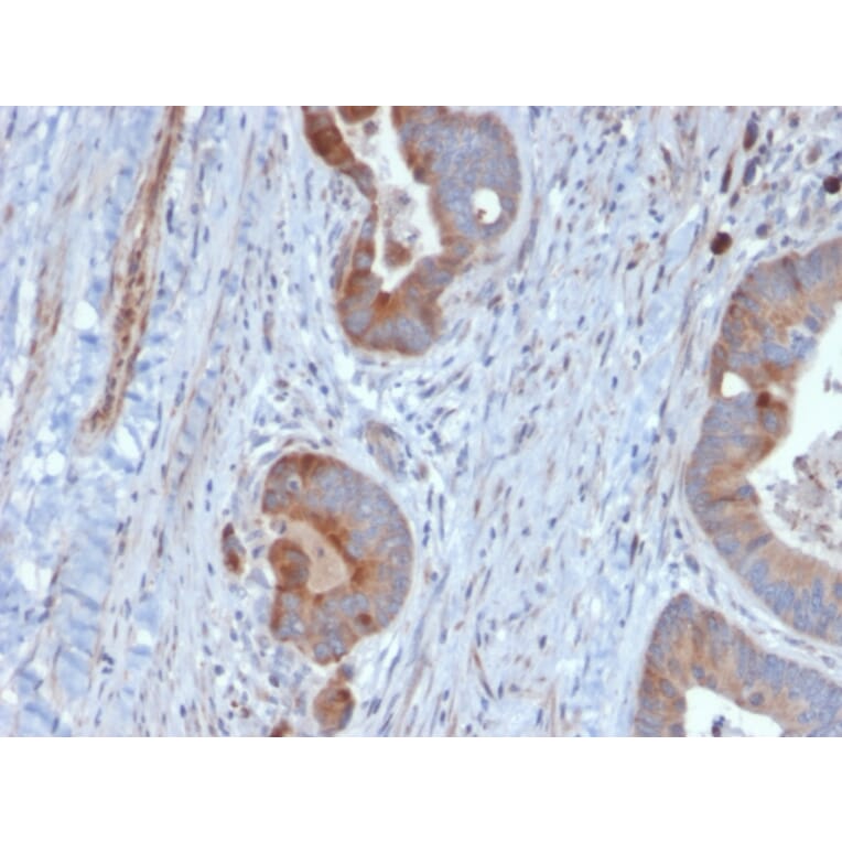 Immunohistochemistry - Anti-Cytokeratin 6B Antibody [KRT6B/2116] (A249132) - Antibodies.com