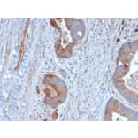 Immunohistochemistry - Anti-Cytokeratin 6B Antibody [KRT6B/2116] (A249132) - Antibodies.com