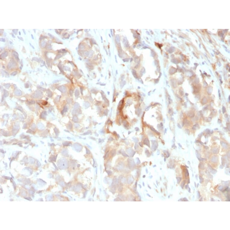 Immunohistochemistry - Anti-Cytokeratin 6B Antibody [KRT6B/2116] (A249131) - Antibodies.com