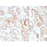 Immunohistochemistry - Anti-Cytokeratin 6B Antibody [KRT6B/2116] (A249131) - Antibodies.com