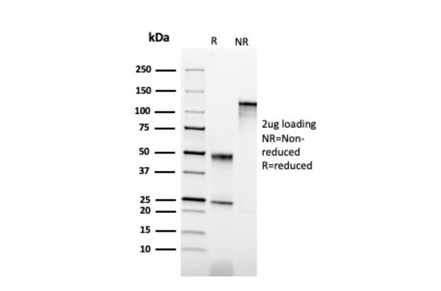 SDS-PAGE - Anti-Cytokeratin 6B Antibody [KRT6B/2116] (A249132) - Antibodies.com