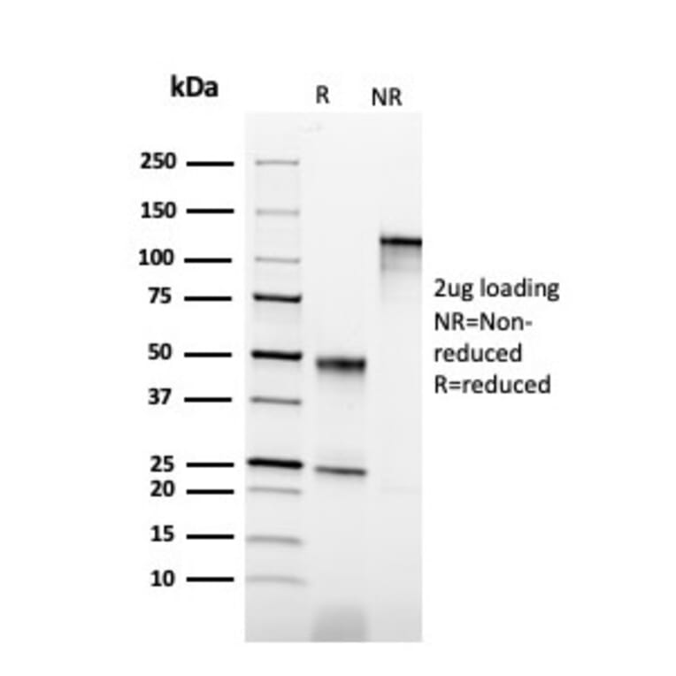 SDS-PAGE - Anti-Cytokeratin 6B Antibody [KRT6B/2116] (A249132) - Antibodies.com