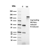SDS-PAGE - Anti-Cytokeratin 6B Antibody [KRT6B/2116] (A249132) - Antibodies.com