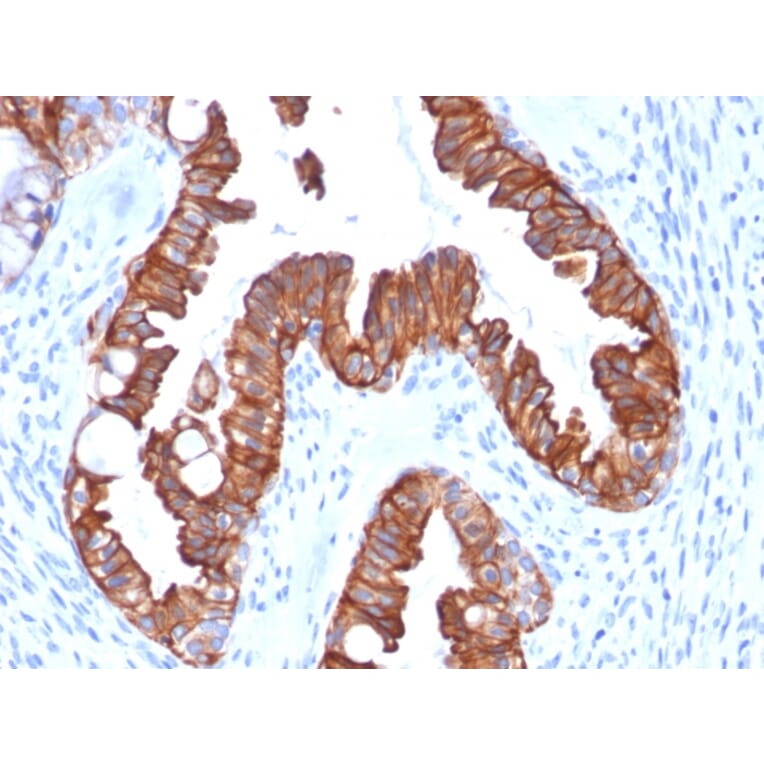 Immunohistochemistry - Anti-Cytokeratin 7 Antibody [rOV-TL12/30] (A249133) - Antibodies.com