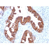 Immunohistochemistry - Anti-Cytokeratin 7 Antibody [rOV-TL12/30] (A249133) - Antibodies.com