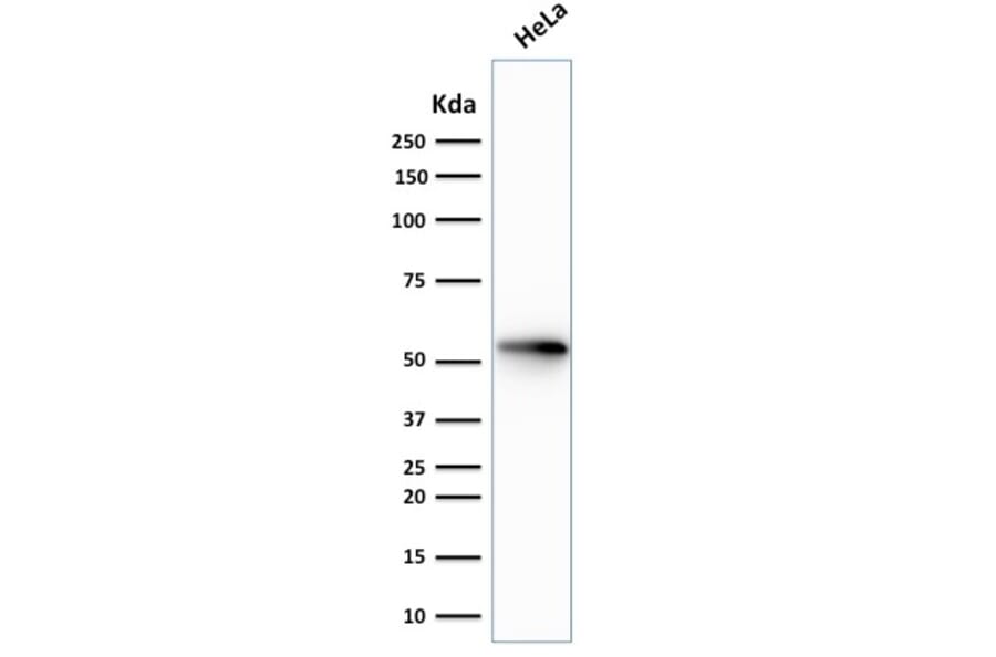 Western Blot - Anti-Cytokeratin 7 Antibody [rOV-TL12/30] (A249133) - Antibodies.com