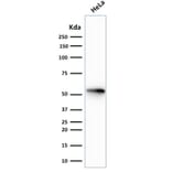 Western Blot - Anti-Cytokeratin 7 Antibody [rOV-TL12/30] (A249133) - Antibodies.com