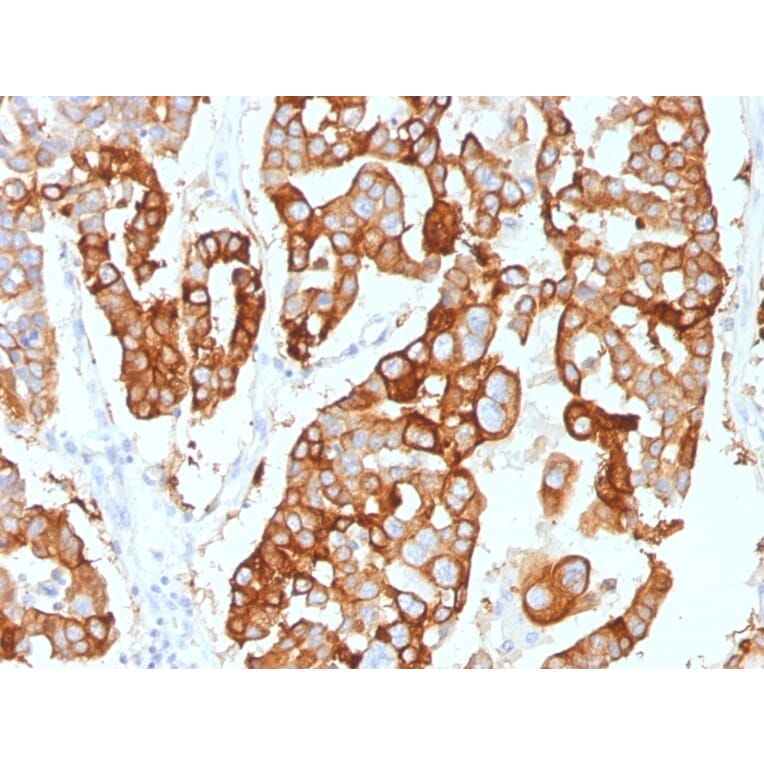 Immunohistochemistry - Anti-Cytokeratin 7 Antibody [KRT7/2200] (A249134) - Antibodies.com