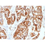 Immunohistochemistry - Anti-Cytokeratin 7 Antibody [KRT7/2200] (A249134) - Antibodies.com