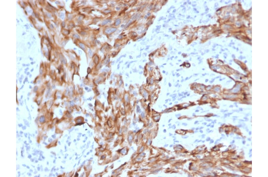 Immunohistochemistry - Anti-Cytokeratin 7 Antibody [KRT7/2200] (A249134) - Antibodies.com