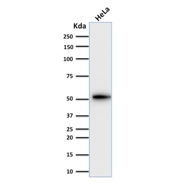 Western Blot - Anti-Cytokeratin 7 Antibody [KRT7/2200] (A249134) - Antibodies.com