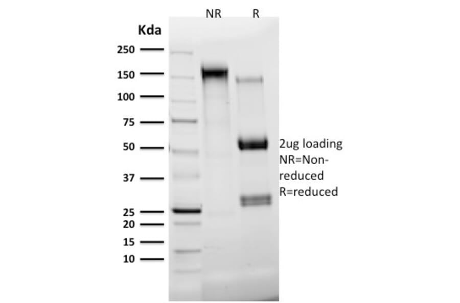 SDS-PAGE - Anti-Cytokeratin 7 Antibody [KRT7/2200] (A249134) - Antibodies.com