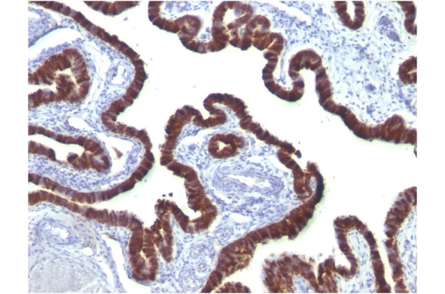 Immunohistochemistry - Anti-Cytokeratin 7 Antibody [OV-TL12/30] (A249135) - Antibodies.com