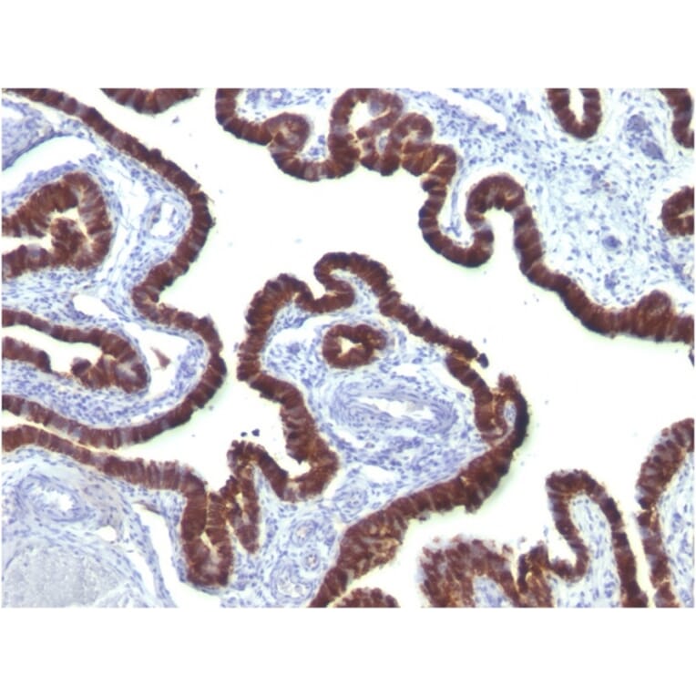 Immunohistochemistry - Anti-Cytokeratin 7 Antibody [OV-TL12/30] (A249135) - Antibodies.com