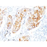 Immunohistochemistry - Anti-Cytokeratin 7 Antibody [OV-TL12/30] (A249135) - Antibodies.com