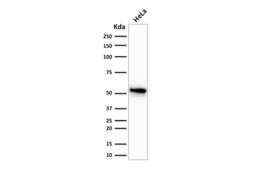 Western Blot - Anti-Cytokeratin 7 Antibody [OV-TL12/30] (A249135) - Antibodies.com