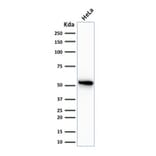 Western Blot - Anti-Cytokeratin 7 Antibody [OV-TL12/30] (A249135) - Antibodies.com