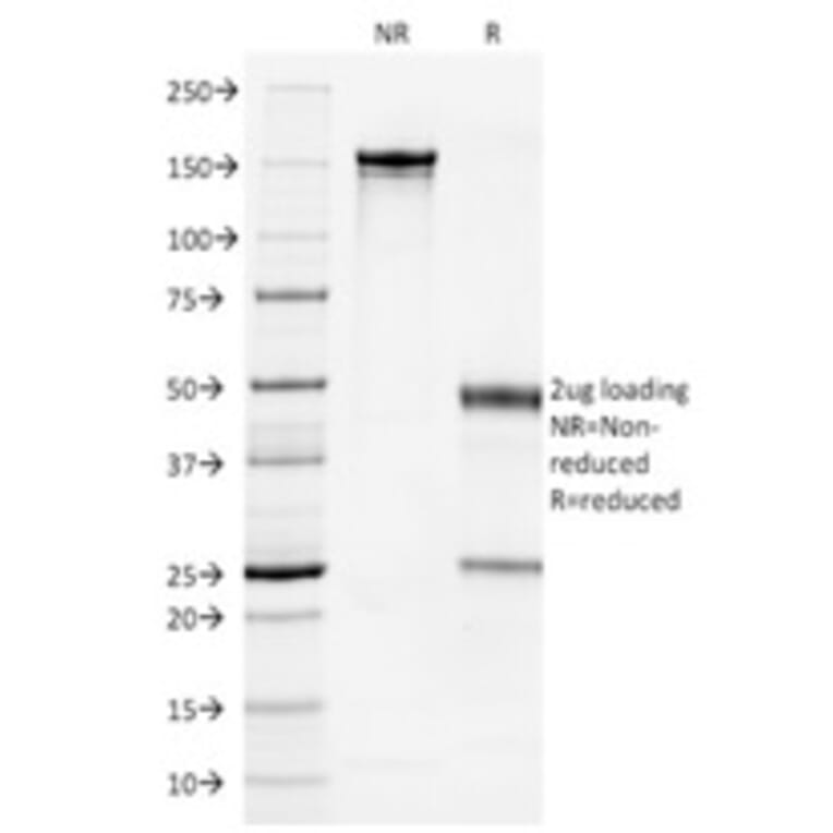 SDS-PAGE - Anti-Cytokeratin 7 Antibody [OV-TL12/30] (A249135) - Antibodies.com