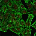 Immunofluorescence - Anti-Cytokeratin 7 Antibody [OV-TL12/30] (A249135) - Antibodies.com