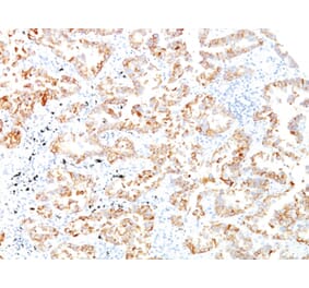 Immunohistochemistry - Anti-Cytokeratin 7 Antibody [SPM270] (A249136) - Antibodies.com