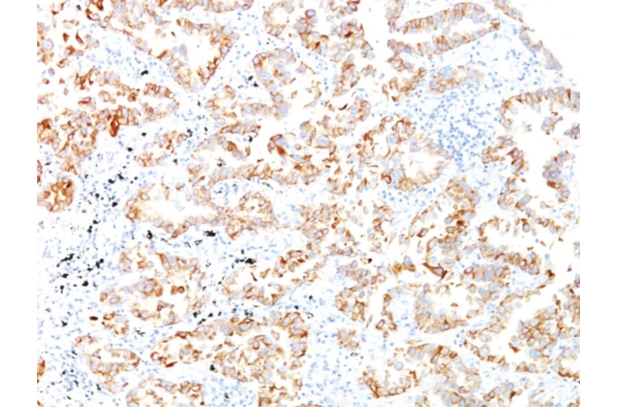 Immunohistochemistry - Anti-Cytokeratin 7 Antibody [SPM270] (A249136) - Antibodies.com