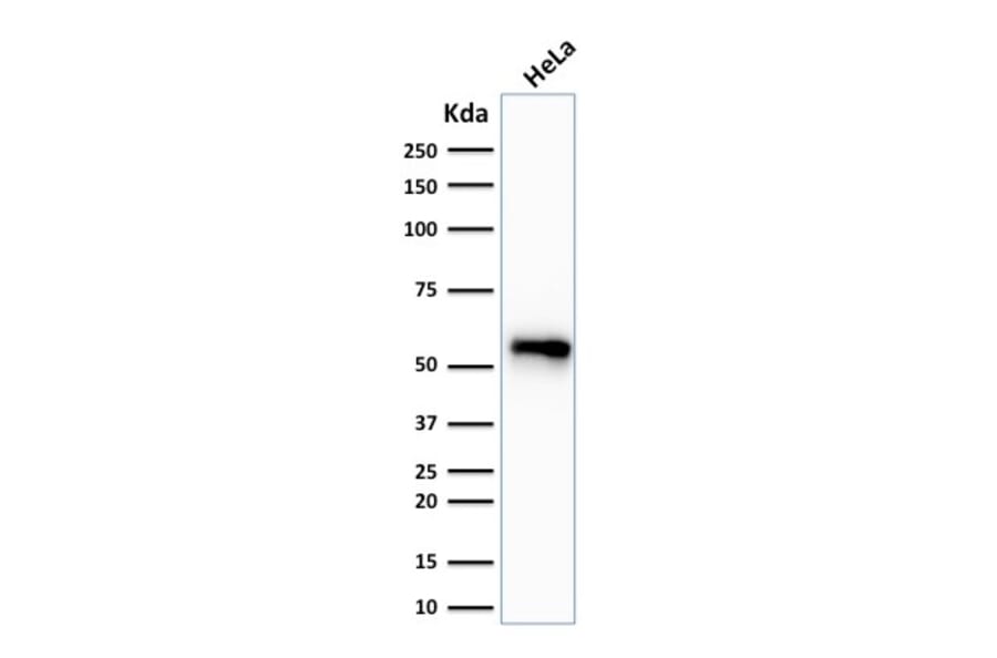 Western Blot - Anti-Cytokeratin 7 Antibody [SPM270] (A249136) - Antibodies.com