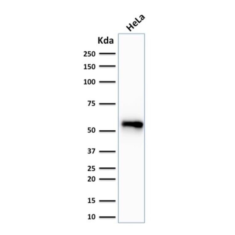 Western Blot - Anti-Cytokeratin 7 Antibody [SPM270] (A249136) - Antibodies.com
